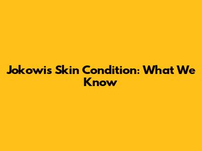 Jokowi's Skin Condition: What We Know